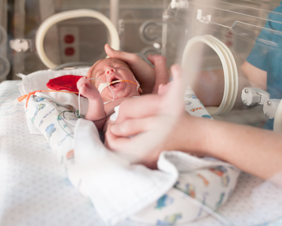 nicu-img